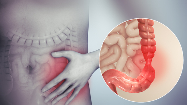 a diagram showing where the pain from IBS originates